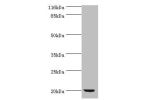 Western blot<br />
All lanes:Peptide deformylase antibody at 2ug/ml+DH5 alpha whole cell lysate<br />
Secondary<br />
Goat polyclonal to rabbit at 1/10000 dilution<br />
Predicted band size: 20kDa<br />
Observed band size: 20kDa<br />