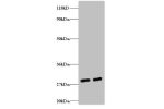Western blot<br />
All lanes: ES1 protein homolog, mitochondrial antibody at 2ug/ml<br />
Lane 1 : EC109 whole cell lysate<br />
Lane 2 : 293T whole cell lysate<br />
Secondary<br />
Goat polyclonal to Rabbit IgG at 1/15000 dilution<br />
Predicted band s
