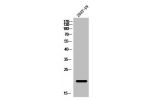 Western Blot analysis of 293T-UV cells using ATF-3 Polyclonal Antibody