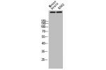 Western Blot analysis of MOUSE-BRAIN K562 cells using Atm Polyclonal Antibody