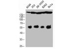 Western Blot analysis of A549 NIH-3T3 SH-SY5Y K562 HELA cells using Cleaved-Notch 4 (V1432) Polyclonal Antibody