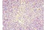 Immunohistochemistry of paraffin-embedded human thymus tissue using CSB-PA022871LA01HU at dilution of 1:100