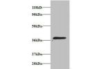 Western blot<br />
V-type proton ATPase subunit E 1 Antibody at 2ug/ml+293T whole cell lysate<br />
Secondary<br />
Goat polyclonal to Rabbit IgG at 1/15000 dilution<br />
Predicted band size: 27,24,23 kDa<br />
Observed band size: 36 kDa<br />