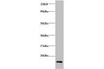 Western blot<br />
All lanes:Cytochrome c oxidase subunit 6A1, mitochondrial Antibody at 2ug/ml+EC109 whole cell lysate<br />
Secondary<br />
Goat polyclonal to Rabbit IgG at 1/15000 dilution<br />
Predicted band size: 12 kDa<br />
Observed band size: 12 