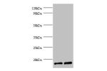 All lanes: Peptidyl-prolyl cis-trans isomerase FKBP1A antibody at 2ug/ml<br />
Lane 1 : EC109 whole cell lysate<br />
Lane 2 : 293T whole cell lysate<br />
Secondary<br />
Goat polyclonal to Rabbit IgG at 1/15000 dilution<br />
Predicted band size: 12 kDa