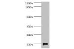 Western blot<br />
All lanes: Ganglioside GM2 activator antibody at 2ug/ml+rat kidney tissue<br />
Secondary<br />
Goat polyclonal to rabbit at 1/10000 dilution<br />
Predicted band size: 21kDa<br />
Observed band size: 21kDa<br />