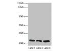 Western blot<br />
All lanes: Ganglioside GM2 activator antibody at 10ug/ml<br />
Lane 1 : Rat liver tissue<br />
Lane 2 : Mouse stomach tissue<br />
Lane 3 : Mouse small intestine tissue<br />
Secondary<br />
Goat polyclonal to Rabbit IgG at 1/10000 dilu