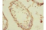 Immunohistochemistry of paraffin-embedded human testis using CSB-PA023898LA01HU at dilution of 1:100