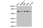 Western Blot<br />
Positive WB detected in:Raji whole cell lysate,Raw264.7 whole cell lysate,CEM whole cell lysate,K562 whole cell lysate,HL-60 whole cell lysate<br />
All lanes:ZAP70 antibody at 3.2