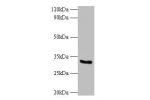 All lanes: NADH-cytochrome b5 reductase 3 Antibody at 2ug/ml<br />
Lane 1:EC109 whole cell lysate<br />
Lane 2: 293T whole cell lysate<br />
Secondary<br />
Goat polyclonal to Rabbit IgG at 1/10000 dilution<br />
Predicted band size: 35,32,39 kDa<br />
Ob