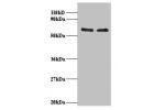 All lanes: RNA-binding protein FUS antibody at 2ug/ml<br />
Lane 1 : 293T whole cell lysate<br />
Lane 2 : EC109 whole cell lysate<br />
Secondary<br />
Goat polyclonal to Rabbit IgG at 1/15000 dilution<br />
Predicted band size: 60kDa<br />
Observed band