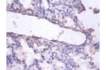 Immunohistochemistry of paraffin-embedded human lung tissue using CSB-PA02745A0Rb at dilution 1:100