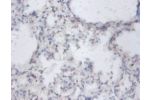 Immunohistochemistry of paraffin-embedded human lung tissue using CSB-PA02757A0Rb at dilution of 1:100