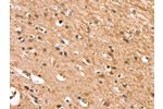 The image on the left is immunohistochemistry of paraffin-embedded Human brain tissue using CSB-PA027621(CSTB Antibody) at dilution 1/30, on the right is treated with synthetic peptide. (Original magnification: 