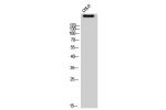 Western Blot analysis of COLO cells using ATR Polyclonal Antibody