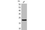 Western Blot analysis of 293 cells using CMTM6 Polyclonal Antibody