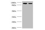 All lanes: Exostosin-like 3 antibody at 2ug/ml<br />
Lane 1:EC109 whole cell lysate<br />
Lane 2:293T whole cell lysate<br />
Secondary<br />
Goat polyclonal to Rabbit IgG at 1/15000 dilution<br />
Predicted bane side:101kDa<br />
Observed band side:101kD