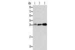 Gel: 12%SDS-PAGE, Lysate: 40 