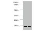 All lanes: Dolichyl-diphosphooligosaccharide-protein glycosyltransferase subunit DAD1 antibody at 2ug/ml<br />
Lane 1 : EC109 whole cell lysate<br />
Lane 2 : 293T whole cell lysate<br />
Secondary<br />
Goat polyclonal to Rabbit IgG at 1/15000 dilution<b