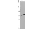 Gel: 6%SDS-PAGE, Lysate: 40 
