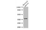Western Blot<br />
Positive WB detected in:Mouse skeletal muscle tissue<br />
All lanes: DNAJB6 antibody at 2.8ug/ml<br />
Secondary<br />
Goat polyclonal to rabbit IgG at 1/50000 dilution<br />
Predicted band size: 37,27,36,31 kDa<br />
Observed band siz