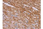 The image on the left is immunohistochemistry of paraffin-embedded Human brain tissue using CSB-PA033129(CRH Antibody) at dilution 1/20, on the right is treated with synthetic peptide. (Original magnification: 