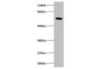 Western blot<br />
Actin-related protein 2/3 complex subunit 3Antibody at 2ug/ml+293T whole cell lysate<br />
Secondary<br />
Goat polyclonal to Rabbit IgG at 1/15000 dilution<br />
Predicted band size: 20 kDa<br />
Observed band size: 75 kDa<br />