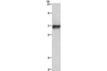Gel: 6%SDS-PAGE,Lysate: 40 