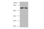 Western blot<br />
All lanes: Polycomb complex protein BMI-1 antibodyt 2ug/ml<br />
Lane 1 : EC109 whole cell lysate<br />
Lane 2 : 293T whole cell lysate<br />
Secondary<br />
Goat polyclonal to Rabbit IgG at 1/15000 dilution<br />
Predicted band size: 3