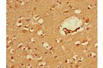 Immunohistochemistry of paraffin-embedded human brain tissue using CSB-PA03389A0Rb at dilution of 1:100