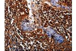 The image on the left is immunohistochemistry of paraffin-embedded Human tonsil tissue using CSB-PA034215(ALPL Antibody) at dilution 1/25, on the right is treated with fusion protein. (Original magnification: 