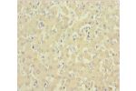 Immunohistochemistry of paraffin-embedded human liver tissue using CSB-PA03474A0Rb at dilution 1:100
