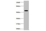 Western blot<br />
All lanes: Gamma-aminobutyric acid receptor-associated protein-like 2 ntibody at 2ug/ml+EC109whole cell lysate<br />
Secondary<br />
Goat polyclonal to Rabbit IgG at 1/15000 dilution<br />
Predicted band size: 13 kDa<br />
Observed band