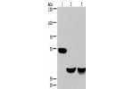 Gel: 6%SDS-PAGE, Lysate: 40 