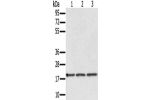 Gel: 12%SDS-PAGE, Lysate: 40 