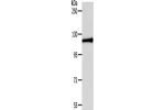 Gel: 8%SDS-PAGE, Lysate: 40 