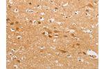 The image on the left is immunohistochemistry of paraffin-embedded Human brain tissue using CSB-PA038132(CDH6 Antibody) at dilution 1/50, on the right is treated with fusion protein. (Original magnification: 