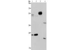 Gel: 8%SDS-PAGE, Lysate: 40 