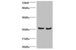 All lanes: DnaJ homolog subfamily B member 1 antibody at 2ug/ml<br />
Lane 1 : EC109 whole cell lysate<br />
Lane 2 : 293T whole cell lysate<br />
Secondary<br />
Goat polyclonal to Rabbit IgG at 1/15000 dilution<br />
Predicted band size: 39,28 kDa<br />