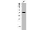 Western Blot analysis of COLO cells using CysLTR2 Polyclonal Antibody