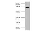 All lanes: AFG3-like protein 2 Antibody at 2ug/ml+EC109 whole cell lysate<br />
Secondary<br />
Goat polyclonal to Rabbit IgG at 1/15000 dilution<br />
Predicted band size: 87.7 kDa<br />
Observed band size: 87.7 kDa<br />