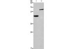 Gel: 8%SDS-PAGE,Lysate: 40 