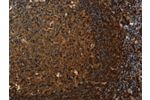 The image on the left is immunohistochemistry of paraffin-embedded Human tonsil tissue using CSB-PA042402(CLDN8 Antibody) at dilution 1/50, on the right is treated with synthetic peptide. (Original magnification: 