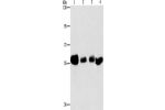 Gel: 10%SDS-PAGE, Lysate: 40 