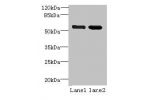 Western blot<br />
All lanes: EFCAB14 antibody at 4ug/ml<br />
Lane 1 : Colo320 whole cell lysate<br />
Lane 2 : Hela whole cell lysate<br />
Secondary<br />
Goat polyclonal to Rabbit IgG at 1/10000 dilution<br />
Predicted band size: 55 kDa<br />
Observe