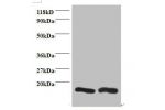 All lanes: Charged multivesicular body protein 2a antibody at 2ug/ml<br />
Lane 1 : EC109 whole cell lysate<br />
Lane 2 : 293T whole cell lysate<br />
Secondary<br />
Goat polyclonal to Rabbit IgG at 1/15000 dilution<br />
Predicted band size: 24 kDa<br 