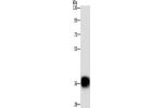 Gel: 10%SDS-PAGE, Lysate: 40 