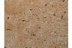 The image on the left is immunohistochemistry of paraffin-embedded Human brain tissue using CSB-PA046504(AATK Antibody) at dilution 1/25, on the right is treated with synthetic peptide. (Original magnification: 