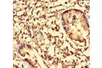 Immunohistochemistry of paraffin-embedded human appendix tissue using CSB-PA04709A0Rb at dilution of 1:100