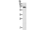 Gel: 8%SDS-PAGE, Lysate: 40 